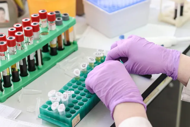 Gloved hands arranging small sample vials in a green rack beside blood collection tubes on a lab bench