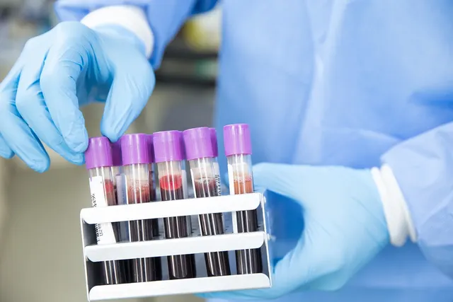 Gloved lab technician in blue gown holding a metal rack of purple-capped sample vials