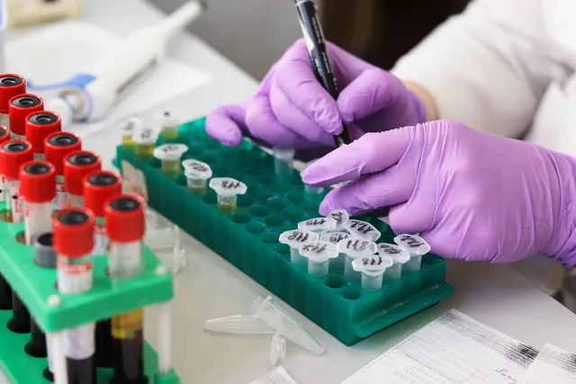 Lab technician in purple gloves labeling numbered sample vials in a green rack beside red-capped blood tubes